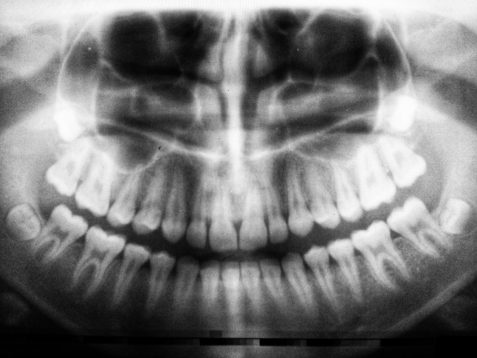 Photo by Umanoide teeth X-ray